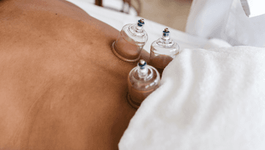 Image for Cupping billed under Naturopathy